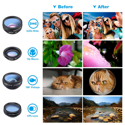 Professional Mobile Photography Set